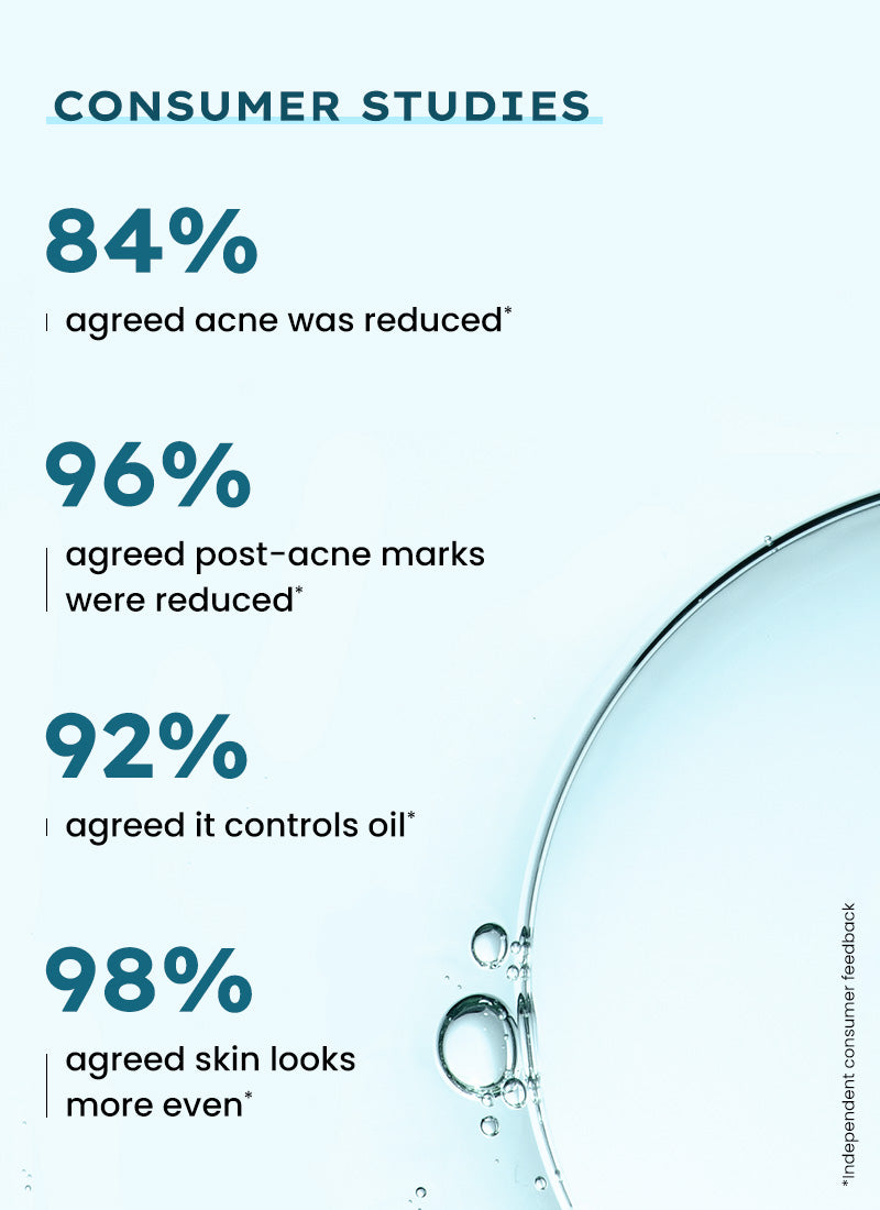 Anti Acne Face Serum with 10% Azelaic Acid & 2% Salicylic Acid - 30 ml