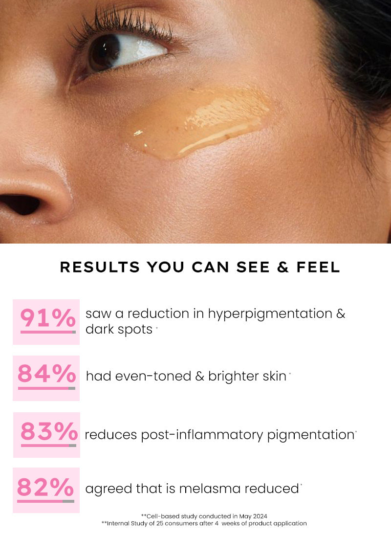 Advanced Glow Serum With 3% Tranexamic Acid & 2% Kojic Acid - 30 ml