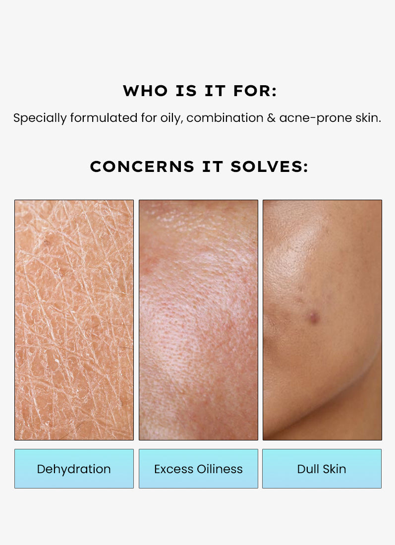 Hyphen 2% Cica Exosomes Oil-Free Moisturizer 100ml - who it is for, dehydration, excess oiliness and dull skin