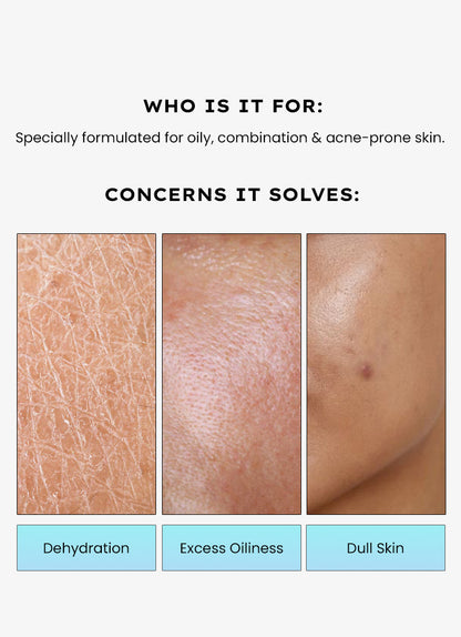 Hyphen 2% Cica Exosomes Oil-Free Moisturizer 100ml - who it is for, dehydration, excess oiliness and dull skin