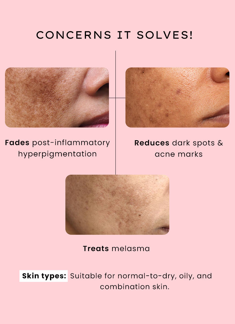 Dual Phase De-pigmentation Serum | 4% Tranexamic Acid- 30ml