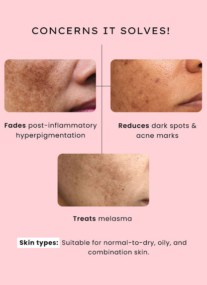 Dual Phase De-pigmentation Serum | 4% Tranexamic Acid- 30ml