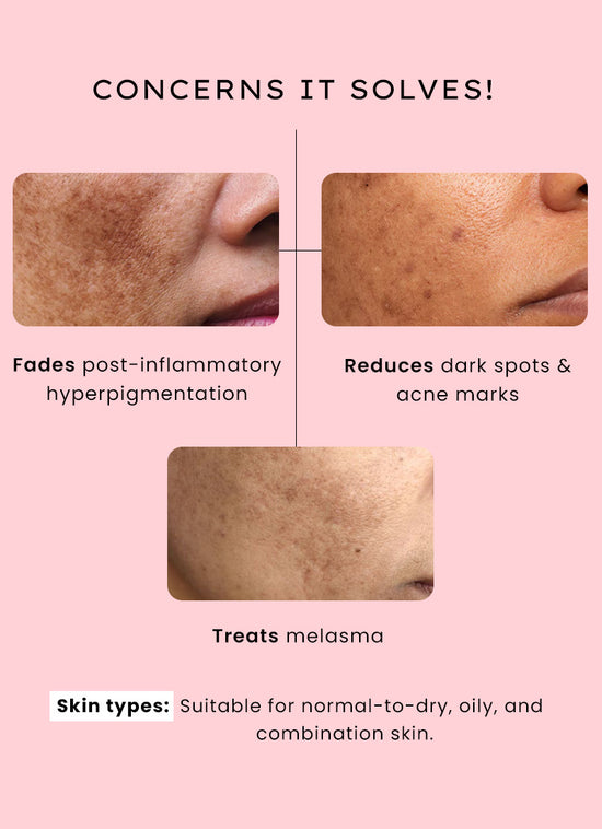 Hyphen Dual Phase Advanced De-Pigmentation Serum 30ml - concerns it solves, pigmentation and dark spots