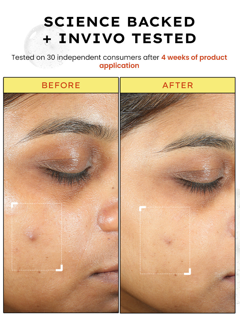 10% Vit C Serum with 1% Vit E & Ferulic Acid | Clinically Tested