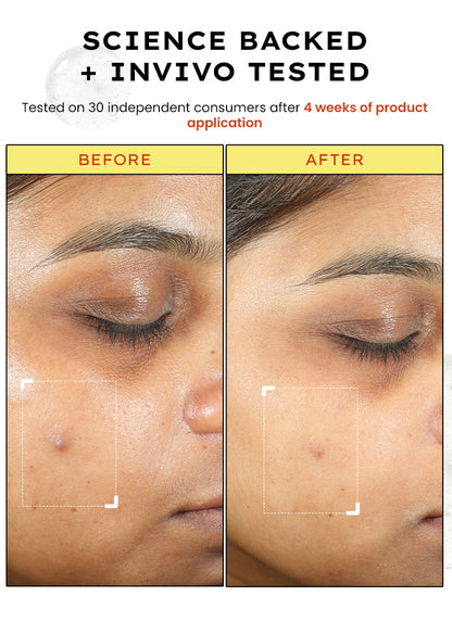 10% Vit C Serum with 1% Vit E & Ferulic Acid | Clinically Tested