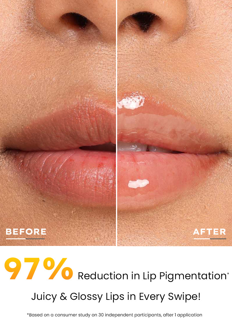 Lipscreen MANGO LIP SCREEN SPF 50 PA++++ WITH 2% KOJIC ACID – HYPHEN