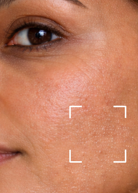 Shop By Concern - Dry to Very Dry Skin