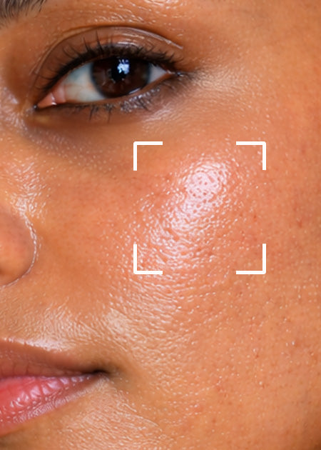 Find Your Product by Concern - Oily Acne Skin