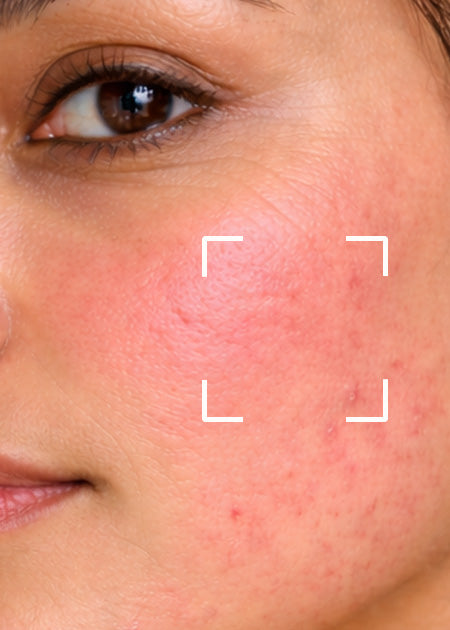 Shop By Concern - Sensitive Skin
