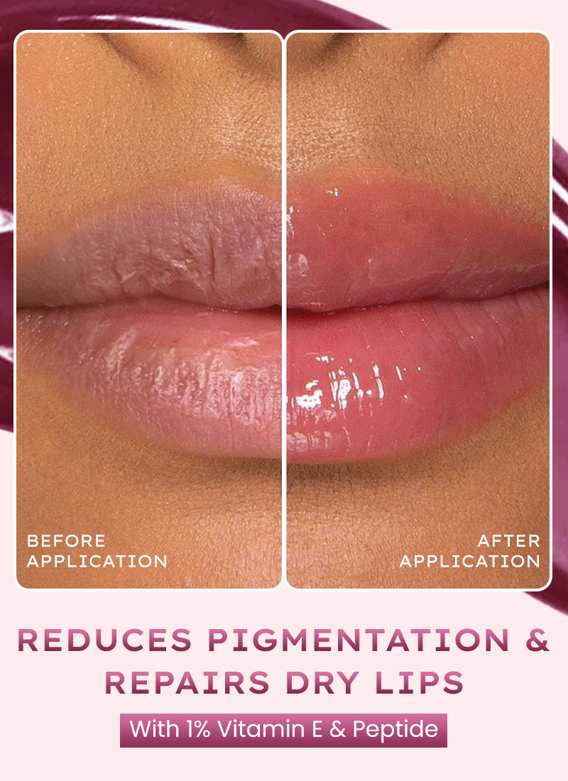 VIP Orchid Lip Balm, 1% Vit E & Peptides- 10g