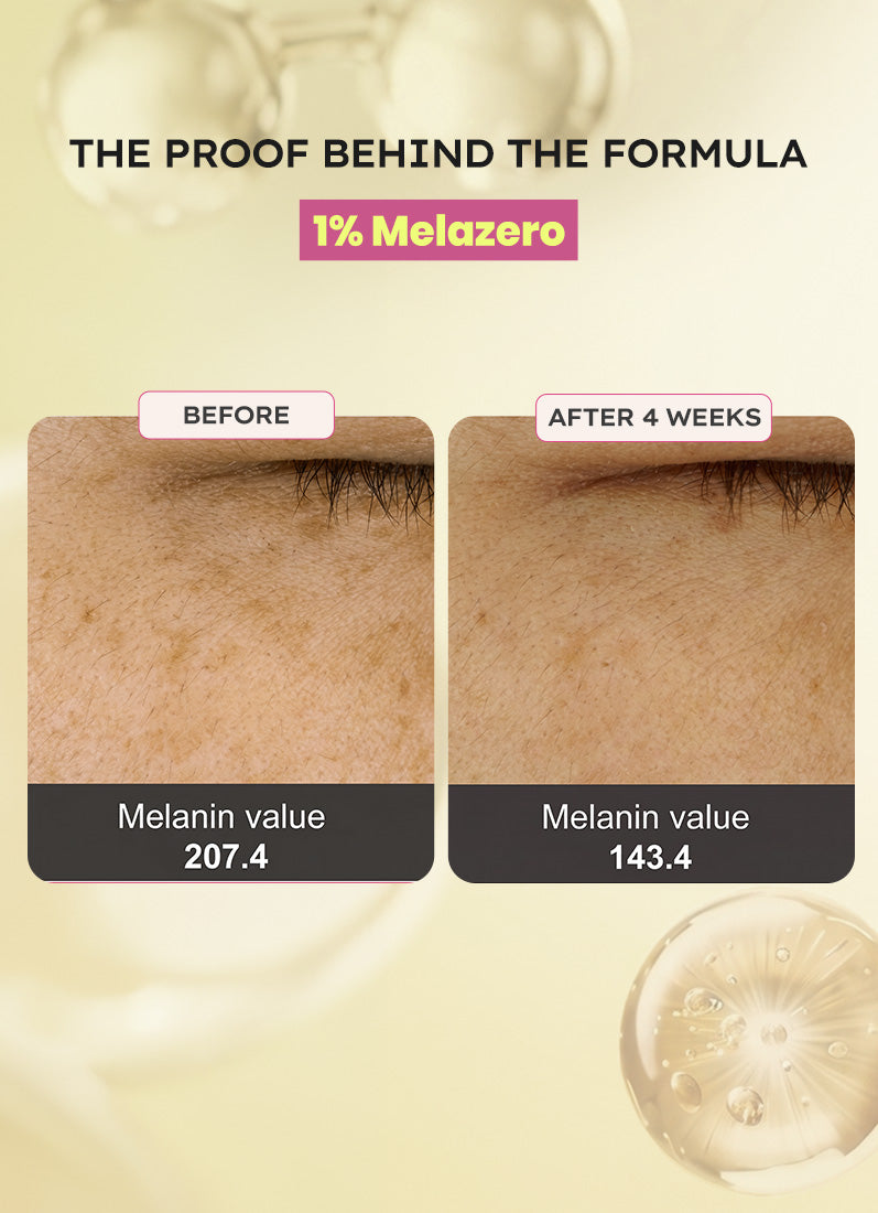 Melanoclear Brightening Moisturizer - 50gm