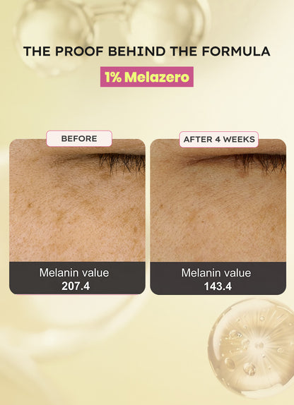 Melanoclear Brightening Moisturizer - 50gm
