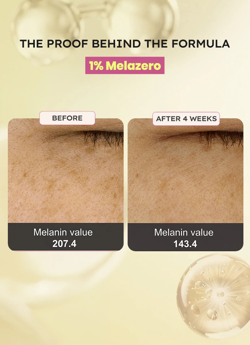 Brightening Moisturizer - 50gm