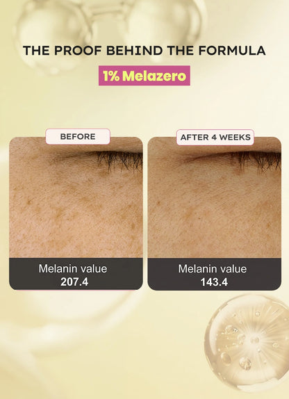 Brightening Moisturizer - 50gm