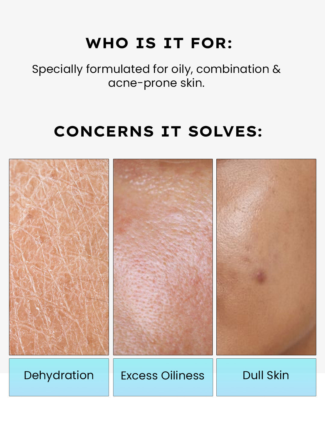 2% Cica Exosomes Oil-Free Moisturizer - 50ml