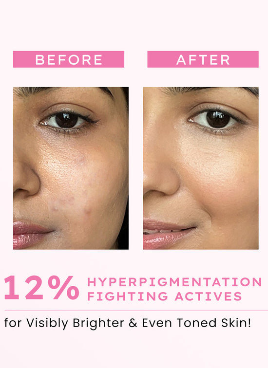 Hyphen Advanced Glow Serum With 3% Tranexamic Acid & 2% Kojic Acid - clinical results chart and benefit claims